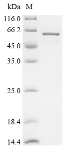 Recombinant Human Y-box-binding protein 1 (YBX1) - image 1