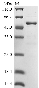 Recombinant Human YjeF N-terminal domain-containing protein 3 (YJEFN3) - image 1