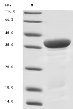 (Tris-Glycine gel) Discontinuous SDS-PAGE (reduced) with 5% enrichment gel and 15% separation gel. (Tris-Glycine gel) Discontinuous SDS-PAGE (reduced) with 5% enrichment gel and 15% separation gel.