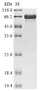 Recombinant Mouse Zinc finger protein 410 (Znf410) - image 1