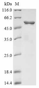 Recombinant Streptococcus agalactiae Group B streptococcal surface immunogenic protein (sip) - image 1