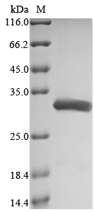 (Tris-Glycine gel) Discontinuous SDS-PAGE (reduced) with 5% enrichment gel and 15% separation gel. (Tris-Glycine gel) Discontinuous SDS-PAGE (reduced) with 5% enrichment gel and 15% separation gel.