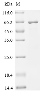 Recombinant Mycobacterium tuberculosis Glutamine synthetase (glnA1) - image 1
