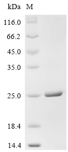 Recombinant Human Calcitonin gene-related peptide 1 (CALCA) - image 1
