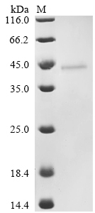 (Tris-Glycine gel) Discontinuous SDS-PAGE (reduced) with 5% enrichment gel and 15% separation gel. (Tris-Glycine gel) Discontinuous SDS-PAGE (reduced) with 5% enrichment gel and 15% separation gel.