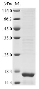 (Tris-Glycine gel) Discontinuous SDS-PAGE (reduced) with 5% enrichment gel and 15% separation gel. (Tris-Glycine gel) Discontinuous SDS-PAGE (reduced) with 5% enrichment gel and 15% separation gel.