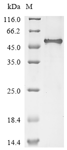 (Tris-Glycine gel) Discontinuous SDS-PAGE (reduced) with 5% enrichment gel and 15% separation gel. (Tris-Glycine gel) Discontinuous SDS-PAGE (reduced) with 5% enrichment gel and 15% separation gel.