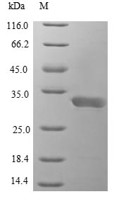 (Tris-Glycine gel) Discontinuous SDS-PAGE (reduced) with 5% enrichment gel and 15% separation gel. (Tris-Glycine gel) Discontinuous SDS-PAGE (reduced) with 5% enrichment gel and 15% separation gel.