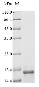 (Tris-Glycine gel) Discontinuous SDS-PAGE (reduced) with 5% enrichment gel and 15% separation gel. (Tris-Glycine gel) Discontinuous SDS-PAGE (reduced) with 5% enrichment gel and 15% separation gel.
