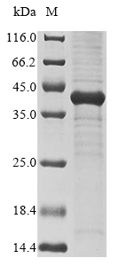(Tris-Glycine gel) Discontinuous SDS-PAGE (reduced) with 5% enrichment gel and 15% separation gel. (Tris-Glycine gel) Discontinuous SDS-PAGE (reduced) with 5% enrichment gel and 15% separation gel.