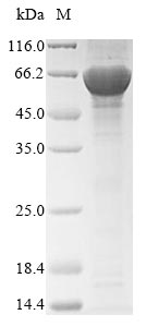 (Tris-Glycine gel) Discontinuous SDS-PAGE (reduced) with 5% enrichment gel and 15% separation gel. (Tris-Glycine gel) Discontinuous SDS-PAGE (reduced) with 5% enrichment gel and 15% separation gel.