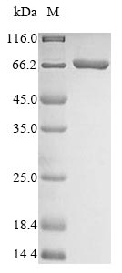 SDS-PAGE- Recombinant protein Candida ACC1