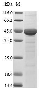 (Tris-Glycine gel) Discontinuous SDS-PAGE (reduced) with 5% enrichment gel and 15% separation gel. (Tris-Glycine gel) Discontinuous SDS-PAGE (reduced) with 5% enrichment gel and 15% separation gel.