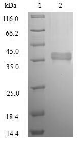 (Tris-Glycine gel) Discontinuous SDS-PAGE (reduced) with 5% enrichment gel and 15% separation gel. (Tris-Glycine gel) Discontinuous SDS-PAGE (reduced) with 5% enrichment gel and 15% separation gel.