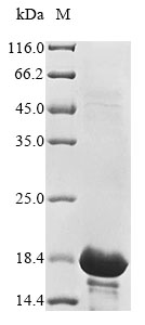 (Tris-Glycine gel) Discontinuous SDS-PAGE (reduced) with 5% enrichment gel and 15% separation gel. (Tris-Glycine gel) Discontinuous SDS-PAGE (reduced) with 5% enrichment gel and 15% separation gel.