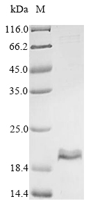 (Tris-Glycine gel) Discontinuous SDS-PAGE (reduced) with 5% enrichment gel and 15% separation gel. (Tris-Glycine gel) Discontinuous SDS-PAGE (reduced) with 5% enrichment gel and 15% separation gel.