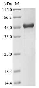 (Tris-Glycine gel) Discontinuous SDS-PAGE (reduced) with 5% enrichment gel and 15% separation gel. (Tris-Glycine gel) Discontinuous SDS-PAGE (reduced) with 5% enrichment gel and 15% separation gel.