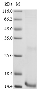 Recombinant Plasmodium falciparum Gametocyte surface protein P230 (PFS230) , partial - image 1