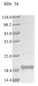 Recombinant Synechocystis sp. Carbon dioxide-concentrating mechanism protein CcmK homolog 2 (ccmK2) - image 1