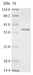 Recombinant Escherichia coli N-acetylmuramoyl-L-alanine amidase AmiD (amiD) - image 1