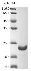 (Tris-Glycine gel) Discontinuous SDS-PAGE (reduced) with 5% enrichment gel and 15% separation gel. (Tris-Glycine gel) Discontinuous SDS-PAGE (reduced) with 5% enrichment gel and 15% separation gel.