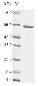 (Tris-Glycine gel) Discontinuous SDS-PAGE (reduced) with 5% enrichment gel and 15% separation gel. (Tris-Glycine gel) Discontinuous SDS-PAGE (reduced) with 5% enrichment gel and 15% separation gel.