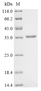 Recombinant Escherichia coli NAD-dependent protein deacylase (cobB) - image 1