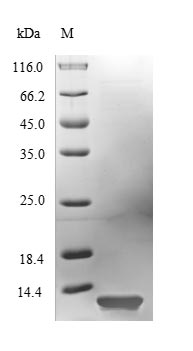 (Tris-Glycine gel) Discontinuous SDS-PAGE (reduced) with 5% enrichment gel and 15% separation gel. (Tris-Glycine gel) Discontinuous SDS-PAGE (reduced) with 5% enrichment gel and 15% separation gel.