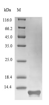 (Tris-Glycine gel) Discontinuous SDS-PAGE (reduced) with 5% enrichment gel and 15% separation gel. (Tris-Glycine gel) Discontinuous SDS-PAGE (reduced) with 5% enrichment gel and 15% separation gel.