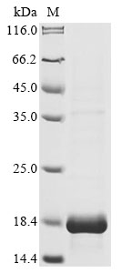 (Tris-Glycine gel) Discontinuous SDS-PAGE (reduced) with 5% enrichment gel and 15% separation gel. (Tris-Glycine gel) Discontinuous SDS-PAGE (reduced) with 5% enrichment gel and 15% separation gel.