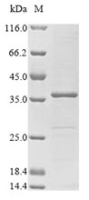 (Tris-Glycine gel) Discontinuous SDS-PAGE (reduced) with 5% enrichment gel and 15% separation gel.