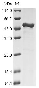 (Tris-Glycine gel) Discontinuous SDS-PAGE (reduced) with 5% enrichment gel and 15% separation gel. (Tris-Glycine gel) Discontinuous SDS-PAGE (reduced) with 5% enrichment gel and 15% separation gel.