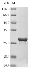 (Tris-Glycine gel) Discontinuous SDS-PAGE (reduced) with 5% enrichment gel and 15% separation gel. (Tris-Glycine gel) Discontinuous SDS-PAGE (reduced) with 5% enrichment gel and 15% separation gel.