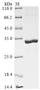 (Tris-Glycine gel) Discontinuous SDS-PAGE (reduced) with 5% enrichment gel and 15% separation gel. (Tris-Glycine gel) Discontinuous SDS-PAGE (reduced) with 5% enrichment gel and 15% separation gel.