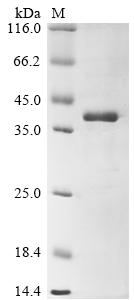 (Tris-Glycine gel) Discontinuous SDS-PAGE (reduced) with 5% enrichment gel and 15% separation gel.