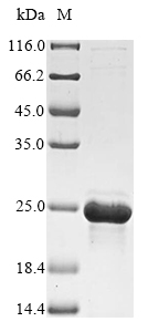 (Tris-Glycine gel) Discontinuous SDS-PAGE (reduced) with 5% enrichment gel and 15% separation gel. (Tris-Glycine gel) Discontinuous SDS-PAGE (reduced) with 5% enrichment gel and 15% separation gel.
