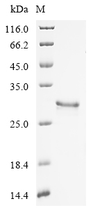 Recombinant Macrovipera lebetina obtusa Disintegrin obtustatin - image 1