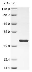 (Tris-Glycine gel) Discontinuous SDS-PAGE (reduced) with 5% enrichment gel and 15% separation gel. (Tris-Glycine gel) Discontinuous SDS-PAGE (reduced) with 5% enrichment gel and 15% separation gel.