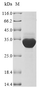 (Tris-Glycine gel) Discontinuous SDS-PAGE (reduced) with 5% enrichment gel and 15% separation gel. (Tris-Glycine gel) Discontinuous SDS-PAGE (reduced) with 5% enrichment gel and 15% separation gel.