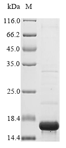 (Tris-Glycine gel) Discontinuous SDS-PAGE (reduced) with 5% enrichment gel and 15% separation gel. (Tris-Glycine gel) Discontinuous SDS-PAGE (reduced) with 5% enrichment gel and 15% separation gel.