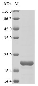 (Tris-Glycine gel) Discontinuous SDS-PAGE (reduced) with 5% enrichment gel and 15% separation gel. (Tris-Glycine gel) Discontinuous SDS-PAGE (reduced) with 5% enrichment gel and 15% separation gel.
