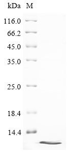 (Tris-Glycine gel) Discontinuous SDS-PAGE (reduced) with 5% enrichment gel and 15% separation gel. (Tris-Glycine gel) Discontinuous SDS-PAGE (reduced) with 5% enrichment gel and 15% separation gel.