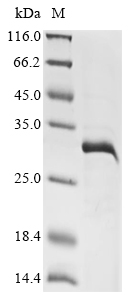 (Tris-Glycine gel) Discontinuous SDS-PAGE (reduced) with 5% enrichment gel and 15% separation gel. (Tris-Glycine gel) Discontinuous SDS-PAGE (reduced) with 5% enrichment gel and 15% separation gel.