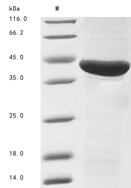 (Tris-Glycine gel) Discontinuous SDS-PAGE (reduced) with 5% enrichment gel and 15% separation gel. (Tris-Glycine gel) Discontinuous SDS-PAGE (reduced) with 5% enrichment gel and 15% separation gel.