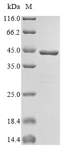 (Tris-Glycine gel) Discontinuous SDS-PAGE (reduced) with 5% enrichment gel and 15% separation gel.