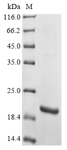 (Tris-Glycine gel) Discontinuous SDS-PAGE (reduced) with 5% enrichment gel and 15% separation gel. (Tris-Glycine gel) Discontinuous SDS-PAGE (reduced) with 5% enrichment gel and 15% separation gel.