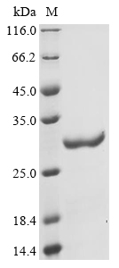 (Tris-Glycine gel) Discontinuous SDS-PAGE (reduced) with 5% enrichment gel and 15% separation gel. (Tris-Glycine gel) Discontinuous SDS-PAGE (reduced) with 5% enrichment gel and 15% separation gel.