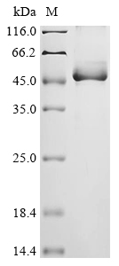 (Tris-Glycine gel) Discontinuous SDS-PAGE (reduced) with 5% enrichment gel and 15% separation gel.