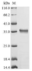 (Tris-Glycine gel) Discontinuous SDS-PAGE (reduced) with 5% enrichment gel and 15% separation gel.