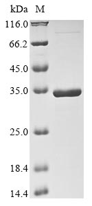 (Tris-Glycine gel) Discontinuous SDS-PAGE (reduced) with 5% enrichment gel and 15% separation gel. (Tris-Glycine gel) Discontinuous SDS-PAGE (reduced) with 5% enrichment gel and 15% separation gel.